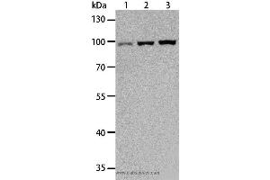 Western blot analysis of Hela, Raji and K562 cell, using TLR3 Polyclonal Antibody at dilution of 1:500 (TLR3 anticorps)