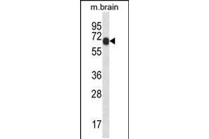 Western blot analysis in mouse brain tissue lysates (35ug/lane).