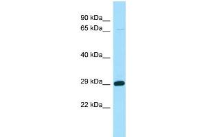 WB Suggested Anti-STARD6 Antibody Titration: 1. (STARD6 anticorps  (N-Term))