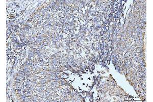 IHC analysis of GRPEL1 using anti-GRPEL1 antibody (ABIN7602643). (GRPEL1 anticorps  (AA 90-217))