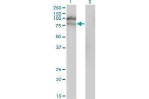 Western Blot analysis of HGS expression in transfected 293T cell line by HGS monoclonal antibody (M01), clone 6D11. (HGS anticorps  (AA 513-612))