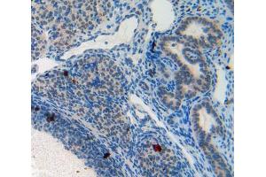 IHC-P analysis of ovary tissue, with DAB staining. (PPL anticorps  (AA 1501-1754))