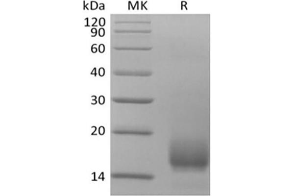 CD59 Protein (CD59) (His tag)