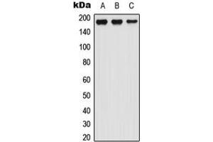Western blot analysis of LTBP1 expression in HEK293T (A), Raw264.