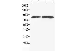 Anti-MTA1 antibody, Western blotting Lane 1: MCF-7 Cell Lysate Lane 2: HELA Cell Lysate Lane 3: JURKAT Cell Lysate Lane 4: CEM Cell Lysate (MTA1 anticorps  (C-Term))