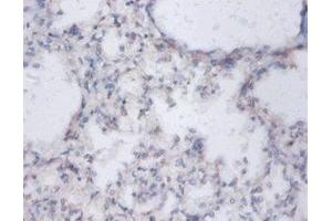 IHC analysis of paraffin-embedded human lung tissue using Diamine acetyltransferase 1 Antibody (1/100 dilution). (SAT1 anticorps  (AA 5-171))