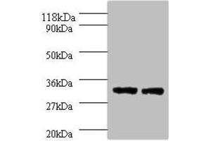 Western blot All lanes: HLA-DPA1 antibody at 2 μg/mL Lane 1: 293T whole cell lysate Lane 2: HepG2 whole cell lysate Secondary Goat polyclonal to rabbit IgG at 1/10000 dilution Predicted band size: 30 kDa Observed band size: 30 kDa