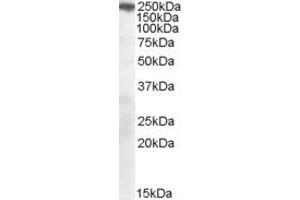 Western Blotting (WB) image for anti-Sortilin-Related Receptor, L(DLR Class) A Repeats Containing (SORL1) (AA 2203-2214) antibody (ABIN297696) (SORL1 anticorps  (AA 2203-2214))