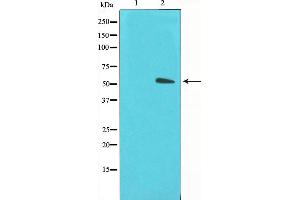 Western blot analysis on LOVO cell lysate using GLUT3 Antibody,The lane on the left is treated with the antigen-specific peptide. (SLC2A3 anticorps  (C-Term))
