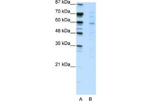WB Suggested Anti-CBFA2T3 Antibody Titration:  2. (CBFA2T3 anticorps  (N-Term))