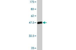 Western Blot detection against Immunogen (50. (PSPH anticorps  (AA 1-225))