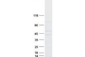 Validation with Western Blot