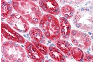 anti-Carboxypeptidase, Vitellogenic-Like (CPVL) (AA 1-477) antibody