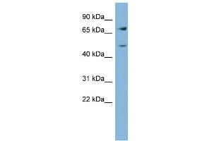 WB Suggested Anti-GFPT2 Antibody Titration:  0. (GFPT2 anticorps  (Middle Region))