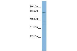 WB Suggested Anti-CYP4F3 Antibody Titration:  0. (CYP4F3 anticorps  (N-Term))