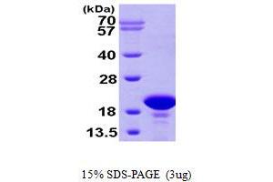 SDS-PAGE (SDS) image for Prefoldin Subunit 2 (PFDN2) (AA 1-154) protein (His tag) (ABIN667258)