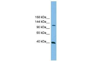 MAP3K14 antibody used at 1 ug/ml to detect target protein.
