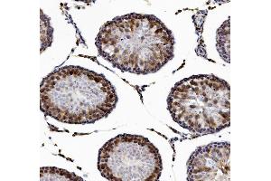 IHC analysis of DAZL using anti-DAZL antibody (ABIN7601384). (DAZL anticorps  (AA 34-281))