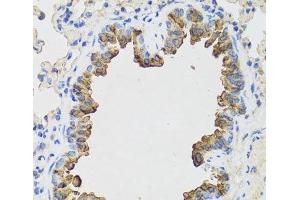 Immunohistochemistry of paraffin-embedded Mouse lung using B9D1 Polyclonal Antibody at dilution of 1:100 (40x lens). (B9D1 anticorps)