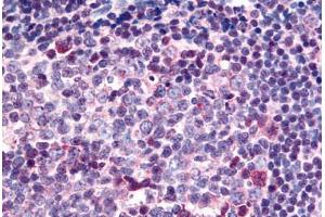 anti-Sterile alpha and TIR Motif Containing 1 (SARM1) (C-Term) antibody