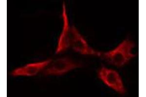 ABIN6274643 staining Hela cells by IF/ICC. (CYP2A6 anticorps  (N-Term))