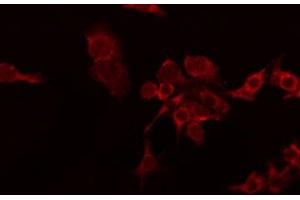 ABIN6274234 staining RAW264. (TNFSF8 anticorps  (Internal Region))