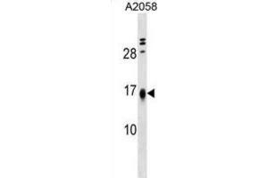 Western Blotting (WB) image for anti-Limb-Bud and Heart (LBH) antibody (ABIN5019448) (LBH anticorps)