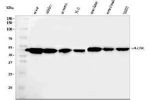 Western blot analysis of ADK using anti-ADK antibody (ABIN4886430). (ADK anticorps  (AA 165-351))
