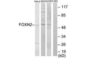Western blot analysis of extracts from HeLa/293/HuvEc cells, using FOXN2 Antibody.