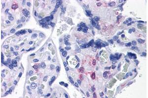 Human Placenta: Formalin-Fixed, Paraffin-Embedded (FFPE) (PLAC1 anticorps  (C-Term))