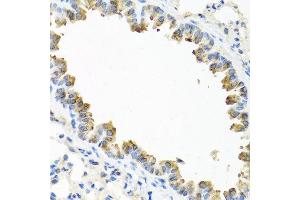 Immunohistochemistry of paraffin-embedded mouse lung using TICAM1 antibody at dilution of 1:100 (40x lens).