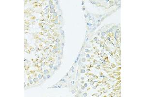 Immunohistochemistry of paraffin-embedded rat testis using MYH10 antibody.