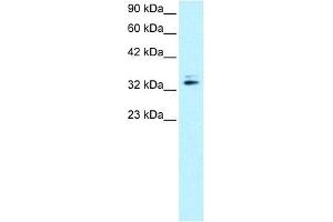 WB Suggested Anti-NR2F6 Antibody   Titration: 0.