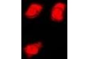Immunofluorescent analysis of FMR1 staining in U2OS cells.