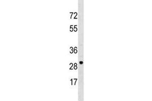 VDAC3 antibody western blot analysis in NCI-H460 lysate.