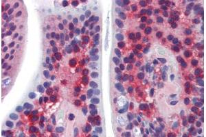 Human Small Intestine (formalin-fixed, paraffin-embedded) stained with SSX2IP antibody ABIN462255 followed by biotinylated goat anti-rabbit IgG secondary antibody ABIN481713, alkaline phosphatase-streptavidin and chromogen.