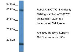 Western Blotting (WB) image for anti-Cancer/testis Antigen 1B (CTAG1B) (C-Term) antibody (ABIN786263) (CTAG1B anticorps  (C-Term))