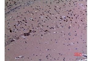 Immunohistochemistry (IHC) analysis of paraffin-embedded Mouse Brain, antibody was diluted at 1:100.