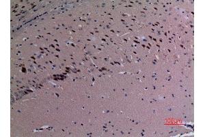 Immunohistochemistry (IHC) analysis of paraffin-embedded Mouse Brain, antibody was diluted at 1:100. (SND1 anticorps  (Internal Region))
