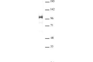 SATB1 antibody (pAb) tested by Western blot. (SATB1 anticorps  (N-Term))