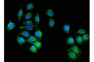 anti-UDP-N-Acteylglucosamine Pyrophosphorylase 1 (UAP1) (AA 1-522) antibody