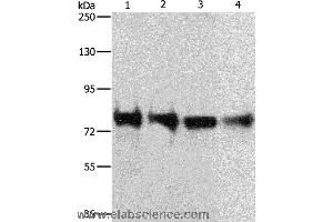 Western blot analysis of 293T, hela, Jurkat and Lovo cell, using CDH6 Polyclonal Antibody at dilution of 1:300 (CDH6 anticorps)