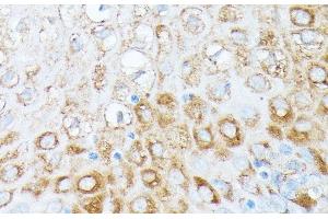 Immunohistochemistry of paraffin-embedded Human esophageal using RPL7 Polyclonal Antibody at dilution of 1:100 (40x lens).
