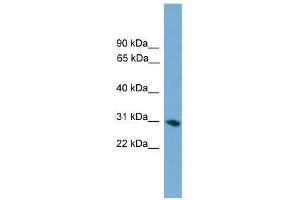 FCN1 antibody used at 0. (FCN1 anticorps  (Middle Region))