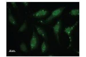 Immunostaining analysis in HeLa cells.