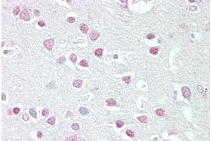 Anti-MC5 Receptor antibody IHC staining of human brain, cortex. (MC5 Receptor anticorps  (AA 24-35))