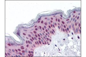 anti-RuvB-Like 2 (E. Coli) (RUVBL2) (Ser129) antibody