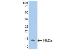 Detection of Recombinant MTNR1A, Caprine using Polyclonal Antibody to Melatonin Receptor 1A (MTNR1A) (Melatonin Receptor 1A anticorps  (AA 312-366))