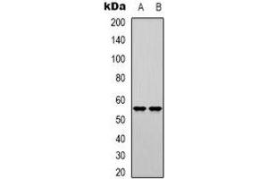 Western blot analysis of DNA Polymerase mu expression in K562 (A), Jurkat (B) whole cell lysates. (POLM anticorps)