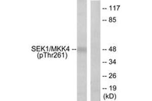 Western blot analysis of extracts from 293 cells treated with UV 15', using SEK1/MKK4 (Phospho-Thr261) Antibody. (MAP2K4 anticorps  (pThr261))